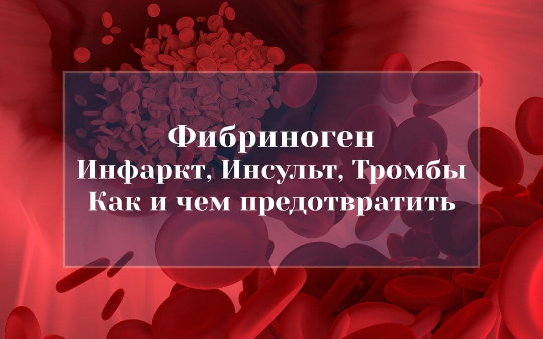 Фибриноген — Инфаркт, Инсульт, Тромбы. Это важно знать!